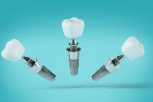 implant-dentar-Megagen