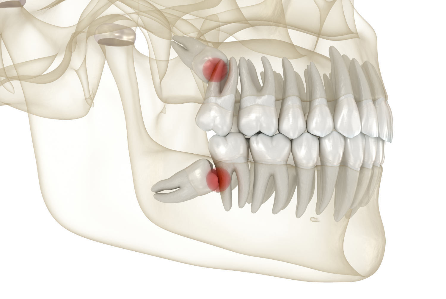 Chirurgia dento-alveolară în cabinetul Dr. Carmen Popa – soluții moderne pentru sănătatea ta dentară